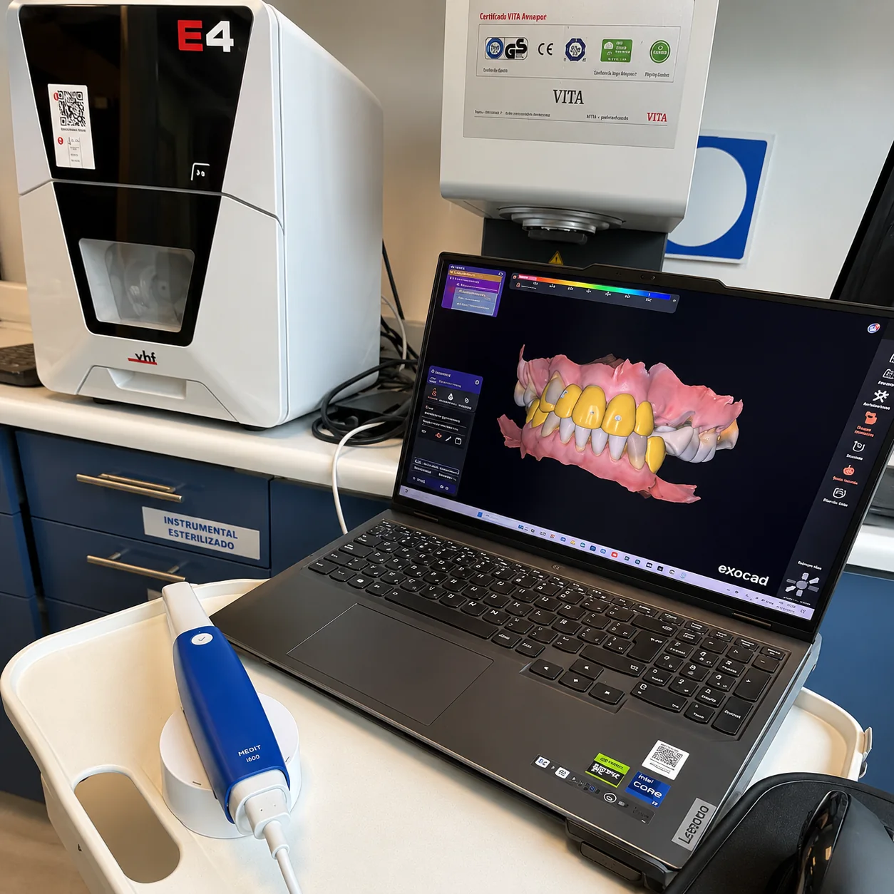 Diseño digital de sonrisa en software clínico