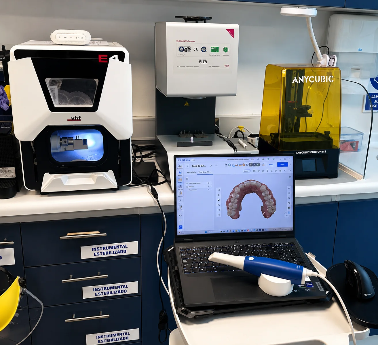 Estación de odontología digital de Rehab Dent con escáner, fresado, horno e impresora 3D Anycubic